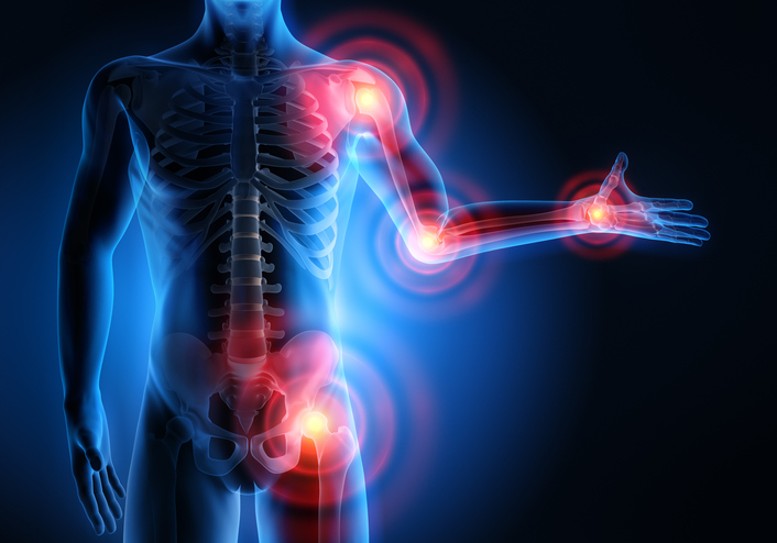 Digital graphic showing highlighted areas of joint pain in the human body, including shoulders, knees, hips, and elbows.