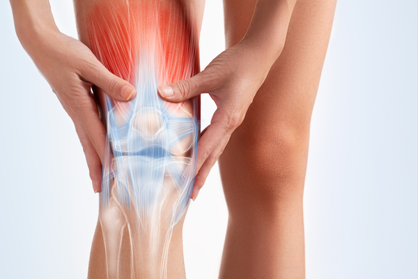 Diagram of a knee joint showing areas affected by arthritis pain and inflammation.